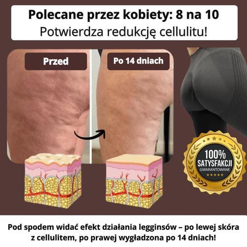 CelluFree  – legginsy antycellulitowe wysmuklające sylwetkę