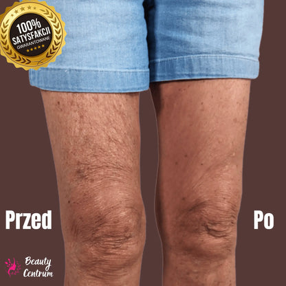 Plastry antycellulitowe - Cellumove